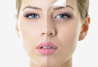 Keratolyse Vegetal Peeling